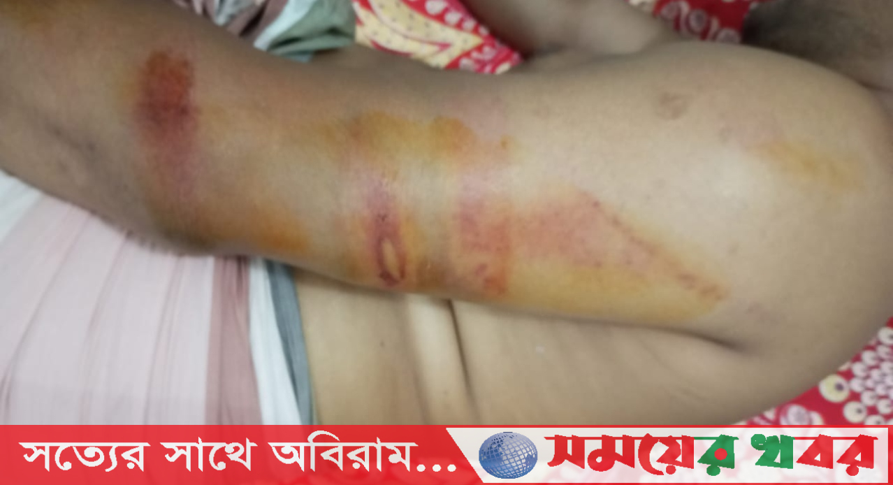 চরফ্যাশনে সহকারী শিক্ষককে পিটিয়ে আহত